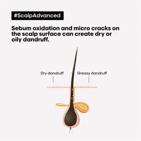 L'Oréal Professionnel Serie Expert Scalp Advanced Anti-Dandruff Dermo-Clarifier Shampoo 1500ml